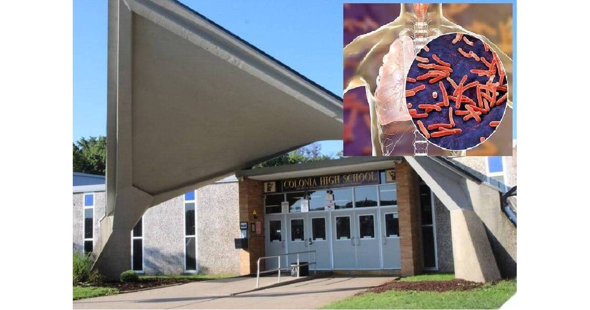 Colonia High Student Treated for Tuberculosis; Others Getting Tested
