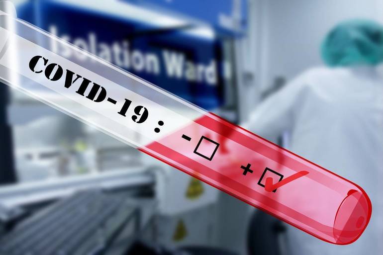 MDH Reports 498 New Cases of COVID-19, 24 More Deaths