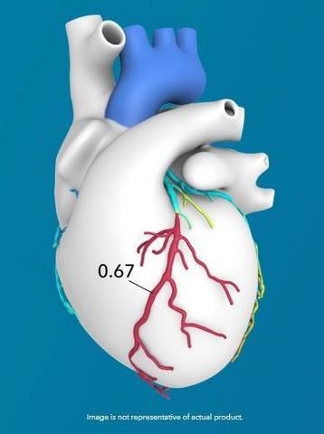 Improving Artery Function and Blood Pressure