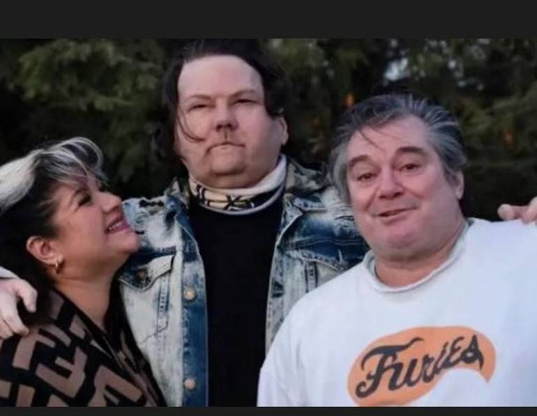 I Never Knew This Was Possible Says Clark Native Joe Dimeo Of Face And Hand Transplant Clark Nj News Tapinto