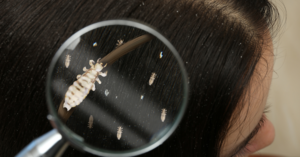 Carousel image 20597616a2080e23b3dc lice canvacr