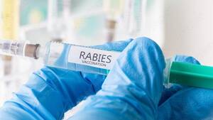 Carousel image 54e87a857363eba8ab52 rabies