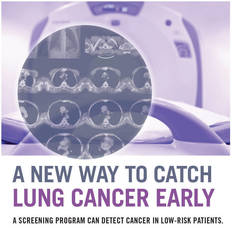 Incidental Lung Nodule Program